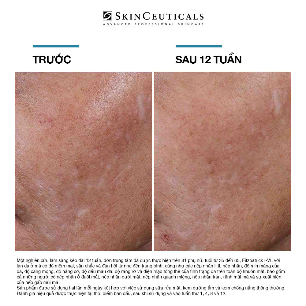 Hyaluronic Acid Intensifier Multi-Glycan