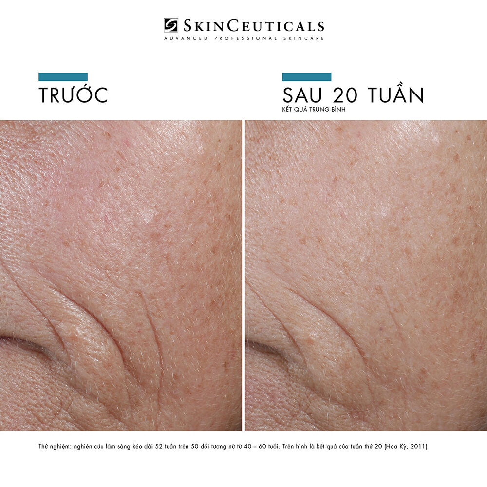 Serum C E Ferulic® với 15% Axit L-Ascorbic