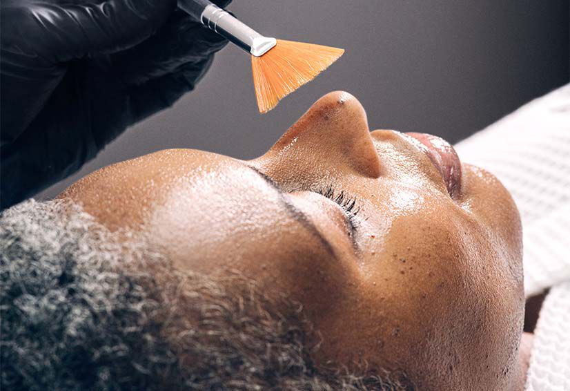 Non-Ablative Laser