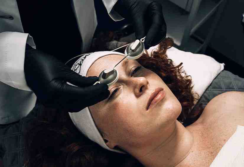 Non-Ablative Laser