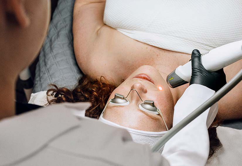 Non-Ablative Laser