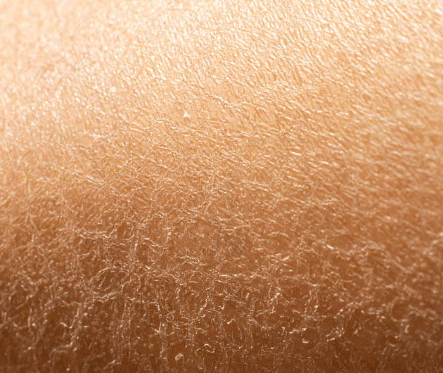 What is Skin Dehydration?